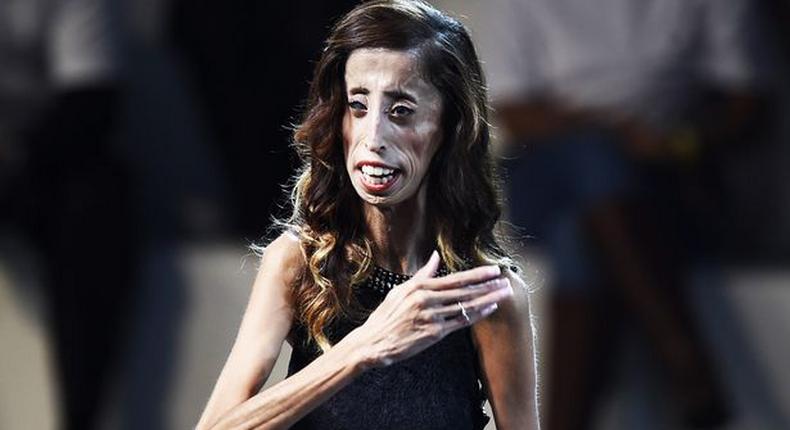 Lizzie Velasquez 