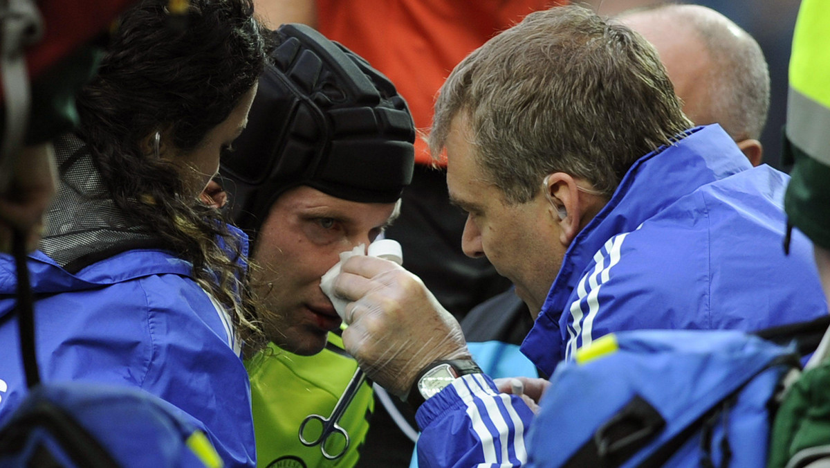 Petr Cech w meczu z Blackburn Rovers (1:0) doznał urazu twarzy i najprawdopodobniej w najbliższych meczach oprócz kasku, będzie nosił ochronną maskę. - Będę wyglądał jak Batman - śmieje się czeski golkiper.