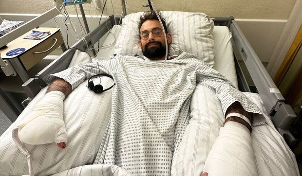 Nemac ostao bez prstiju i nogu