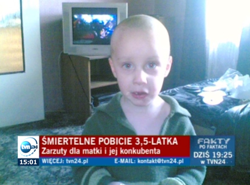 Zwyrodnialec ciął dziecko szkłem