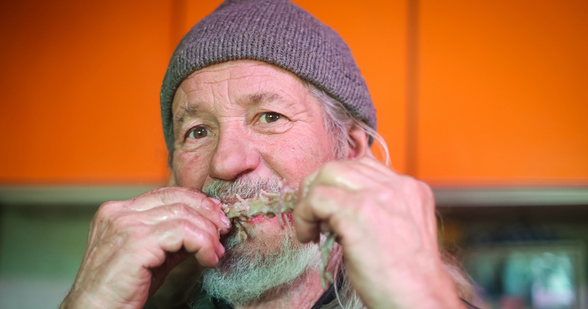 Po zębach ich poznacie. Zaporowe ceny w USA, na leczenie mało kogo stać