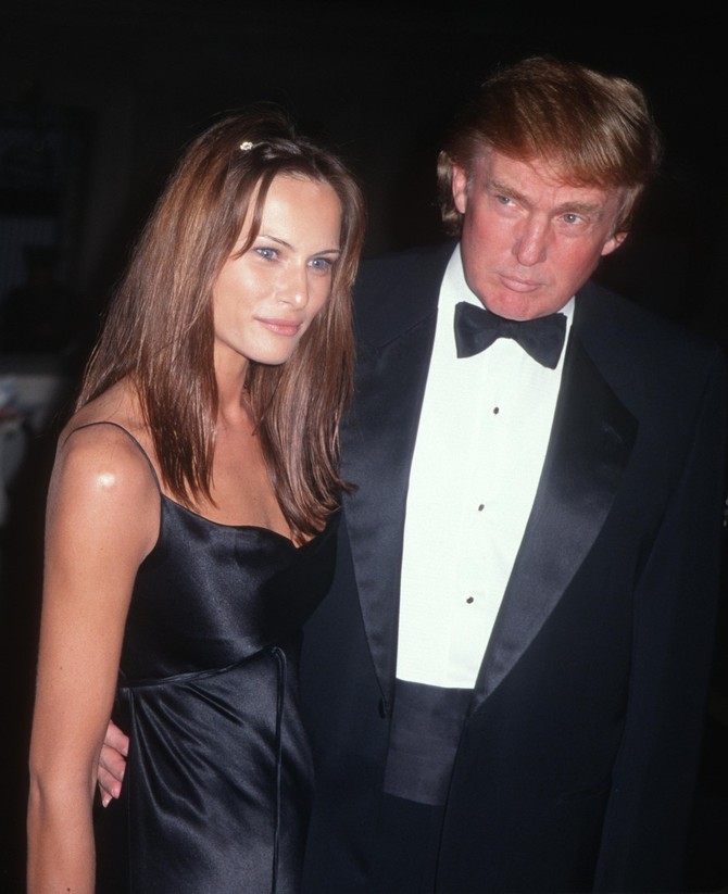 Sve plastične operacije Melanije Tramp