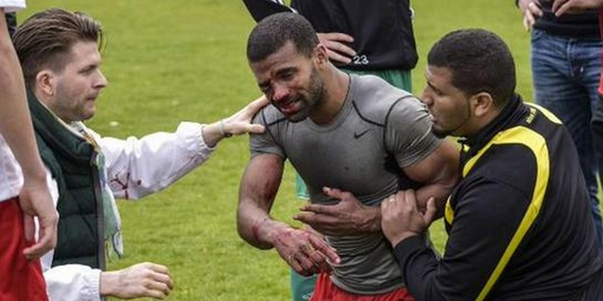 Brutalnie pobici piłkarze na meczu Berliner SC vs Sparta