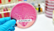 Bakteria E. coli - objawy zakażenia, profilaktyka