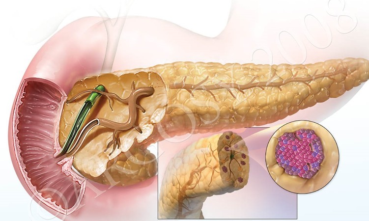 pancreas_0