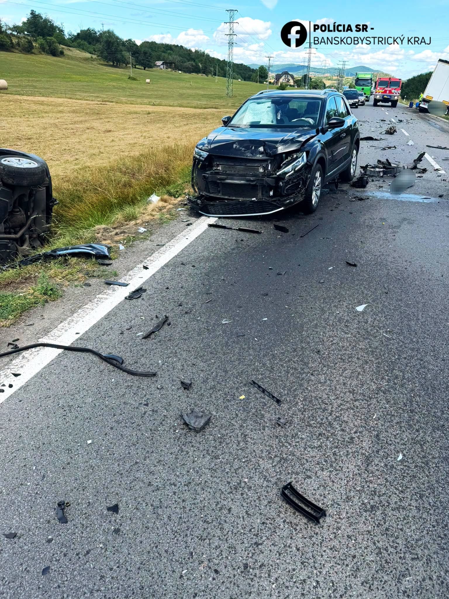 Pri Krupine sa zrazil kamión s dvomi osobnými autami.