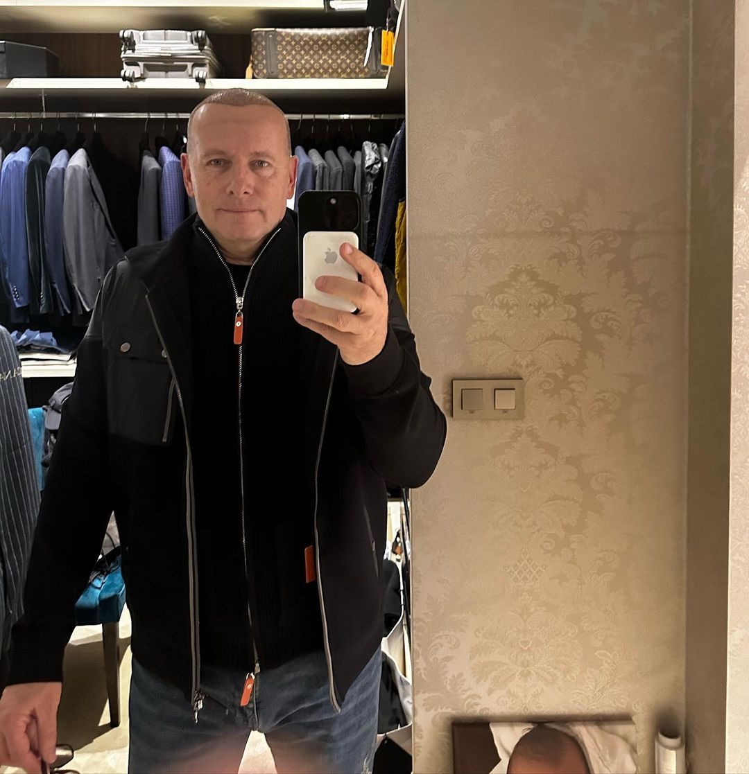 Boris Kollár niekoľko dní po transplantácii vlasov.