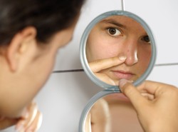 To nie jest błaha dolegliwość. Trądzik dotyka 90 proc. osób w wieku dorastania