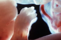 Csoda: majdnem harminc éve lefagyasztott embrióból született egészséges kislány