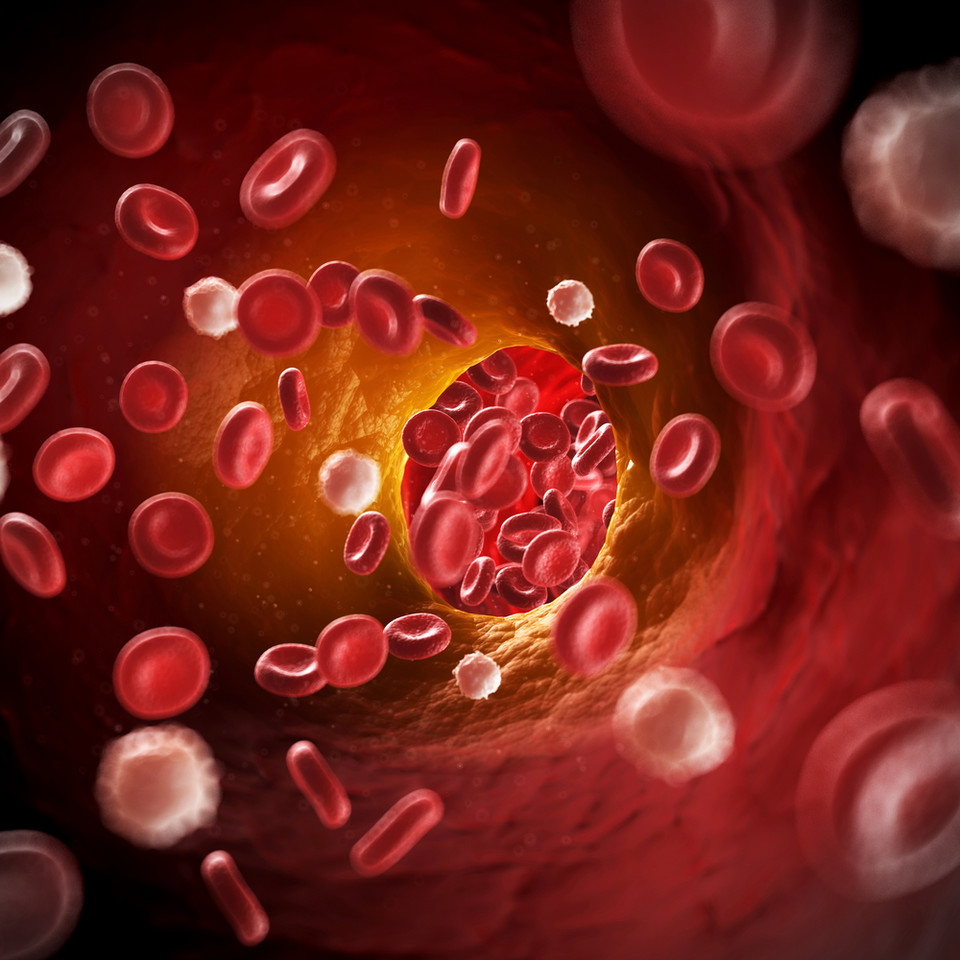 Cynamon na obniżenie poziomu cholesterolu i cukru we krwi 