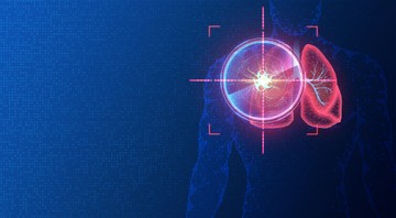 Mesterséges intelligencia: már a korai stádiumban felismerheti a rákot?