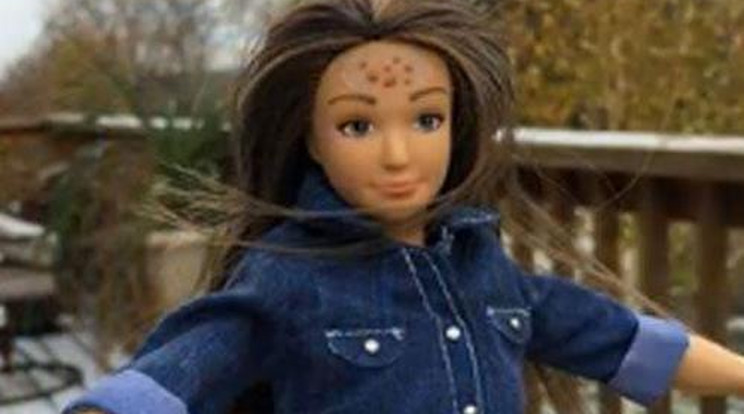 Jönnek a pattanásos és narancsbőrös Barbie-k!