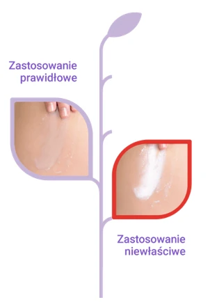 Jak stosować Sudocrem