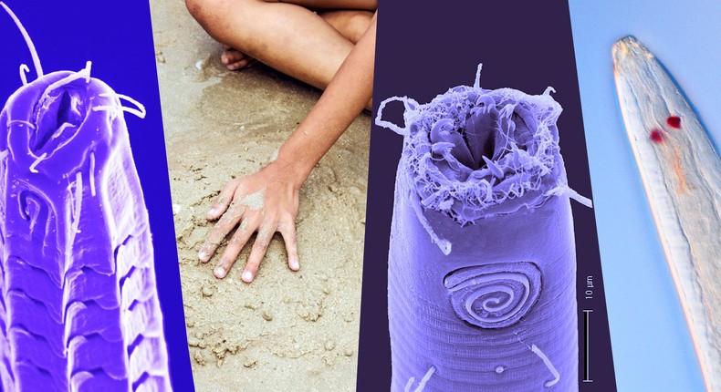 Thousands of species of nematodes live in your average handful of sand.Jim Baldwin and Manuel Mundo-Ocampo; Mirayana Marcelino Barros; Getty; Insider