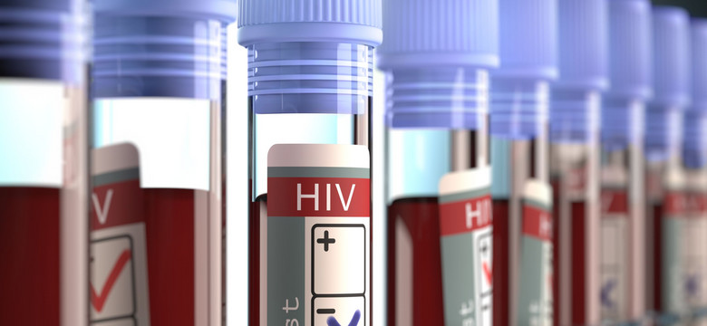 Musimy traktować test na HIV jak morfologię. Liczba zarażonych stale rośnie