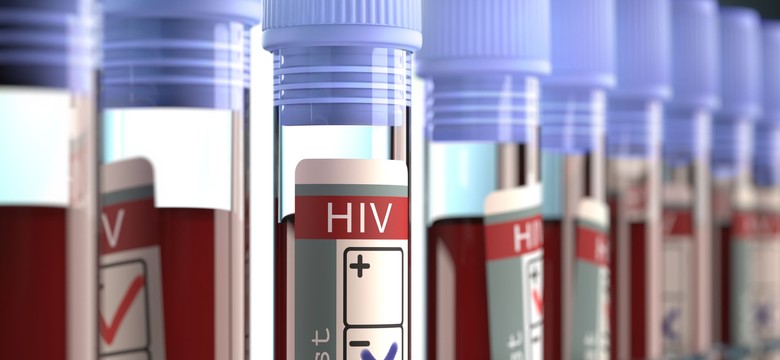 Musimy traktować test na HIV jak morfologię. Liczba zarażonych stale rośnie