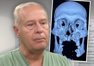 Na čelu hirurškog tima koji je izveo operaciju bio je  maksilofacijalni hirurg doc. dr Srbislav Pajić