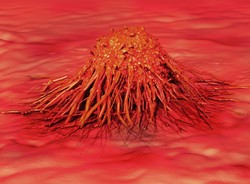 Nowy wynalazek: ultrasonograf, który pomoże leczyć raka