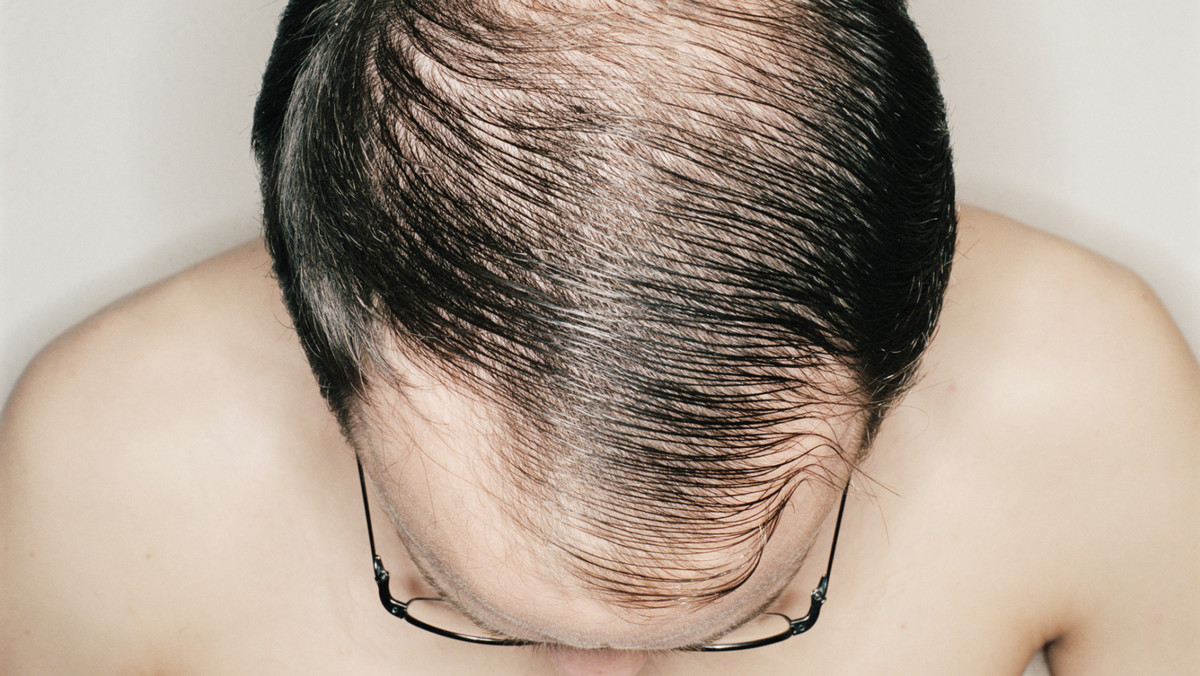 Tego momentu boi się prawie każdy mężczyzna: fryzjer pyta, czy czesać tak, by zamaskować łysinę.