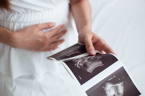 Első gyermekét várja a Megasztár énekesnője Fotó: Getty Images