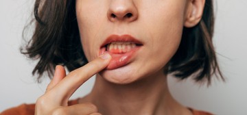 A leukémia a szájában is okozhat panaszokat - ezekre a tünetekre figyeljen