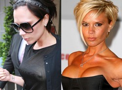 Oto kobiety, które chcą zmniejszyć biust