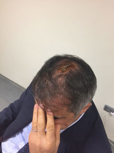 Senol Gunes z rozbitą głową trafił do szpitala. Meczu Fenerbahce - Besiktas z powodu zamieszek nie dokończono