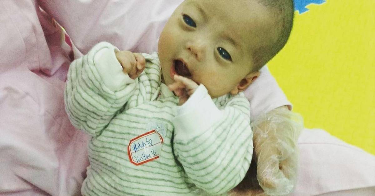 Gdy matka zobaczyła po porodzie jej oczy, porzuciła ją. Dziecko trafiło do sierocińca