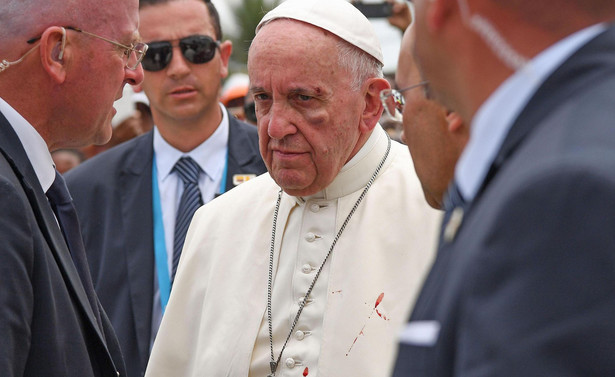 Papież Franciszek miał wypadek. Uderzył w metalową rurkę w papamobile