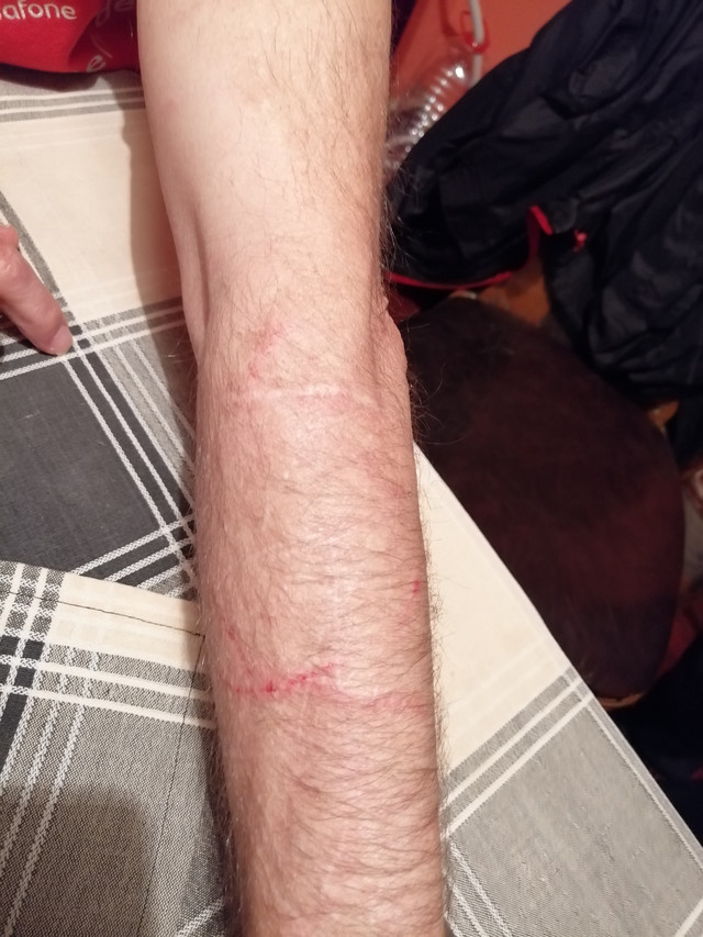 The attacked man received scratches