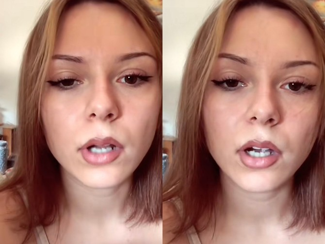 Sara ima 20 godina i zbog promaje joj je paralisana desna strana lica