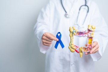 Egyre nő a fiatal vastagbélrákos esetek száma - az onkológus szerint ez lehet az oka