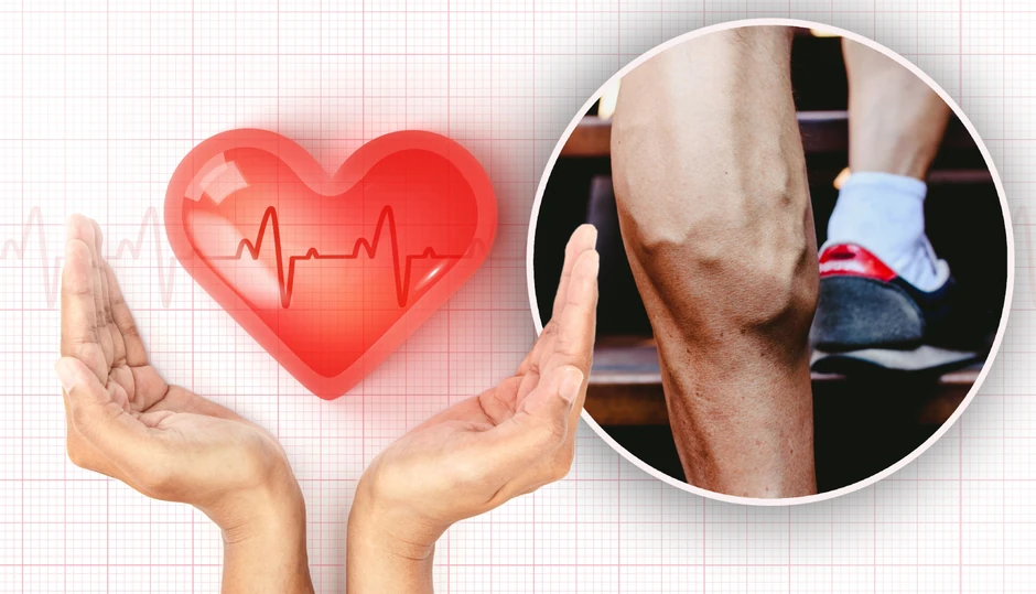 Bol u nogama je znak i srčanih oboljenja