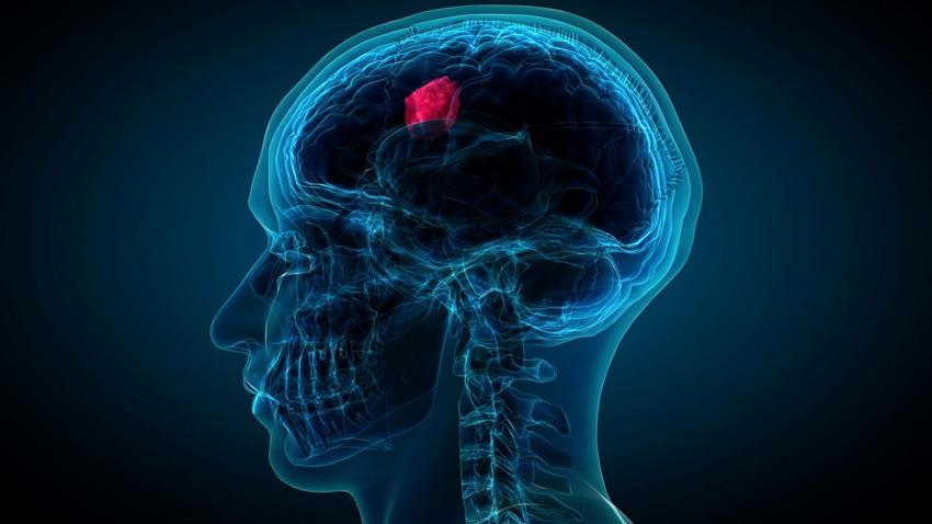 kutatás agydaganat rák tumor sejtosztódás