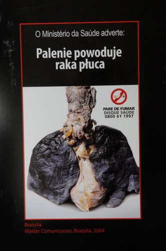 Z okazji Światowego Dnia Bez Tytoniu ministerstwo zdrowia zorganizowało wystawę grafik, jakie w różnych krajach straszą z paczek papierosów