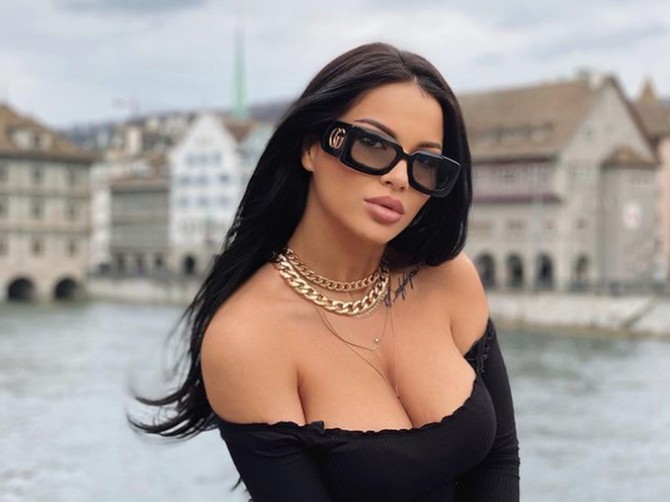 Dajana Drobnjj+ak o borbi sa psorijazom