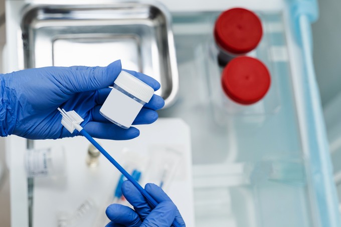 Barna hüvelyi folyás miatt lehet téves a HPV szűrés eredménye? Az orvos válaszol