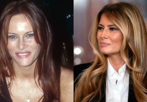 Melanija Tramp nekad i sad