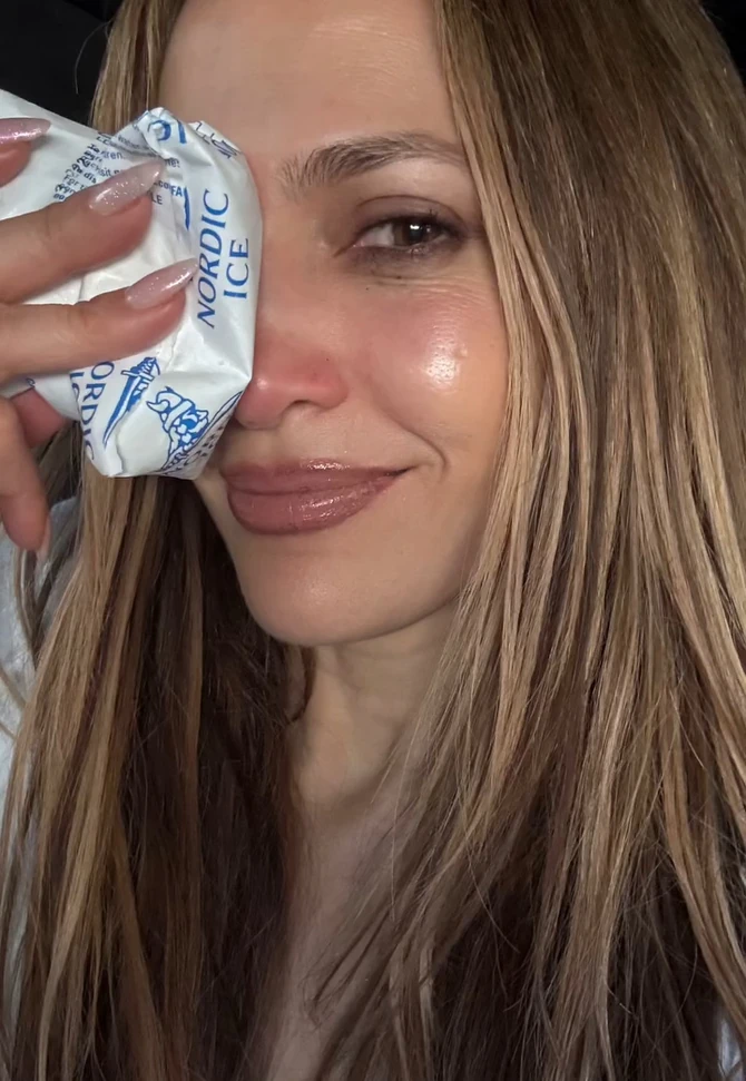 Dženifer Lopez posle incidenta na probi