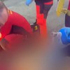 Operacija srca na ulici u Mađarskoj 