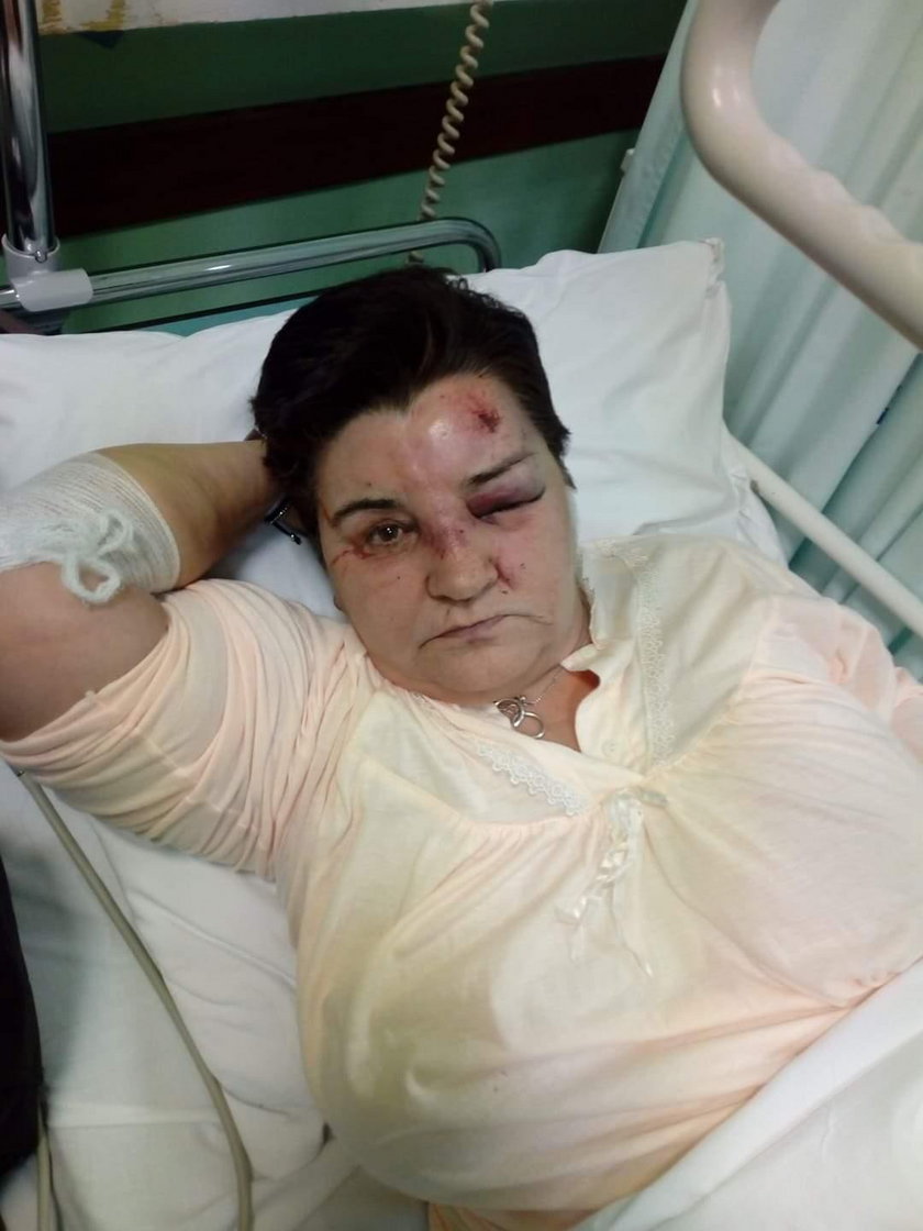 Rogowo: Pacjentka pobita w domu pomocy społecznej