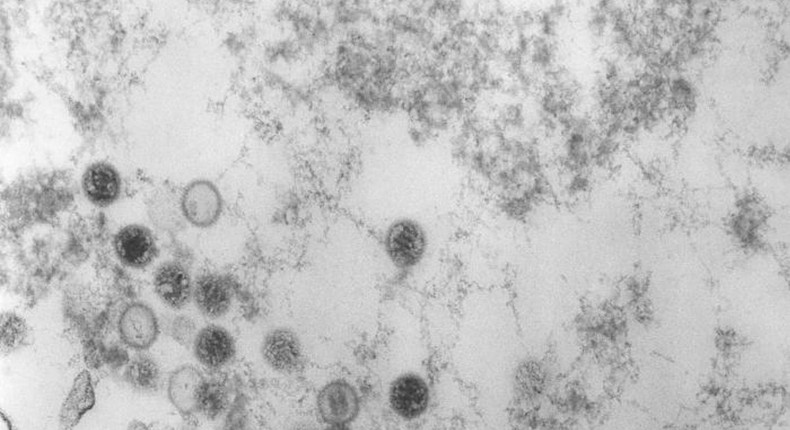 Particles of the mononucleosis virus (dark circles) inside a cell.