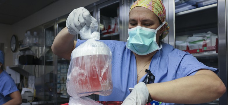 Zmarł pierwszy biorca przeszczepu genetycznie zmodyfikowanej nerki świni