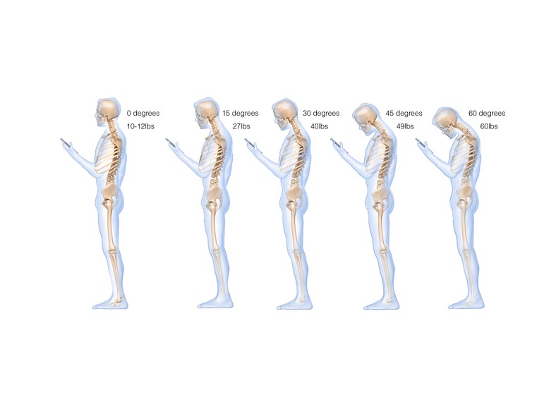 Texting_and_Mobile_Usage_Does_to_Your_Spine