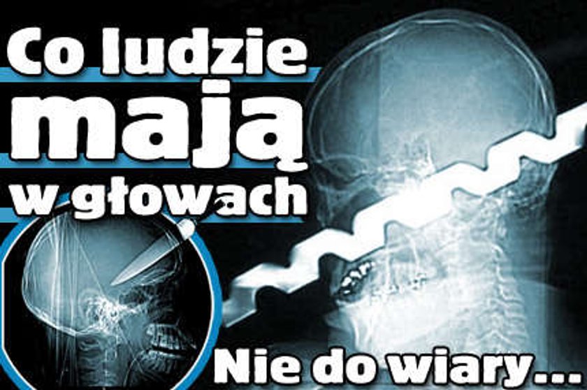 Co ludzie mają w głowach!