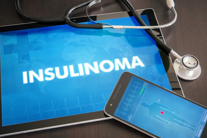 Inzulinóma