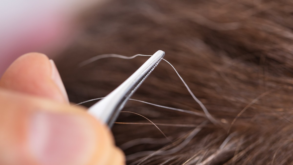 Kada se dlaka iščupa, izvlači se samo koren, dok folikul ostaje netaknut