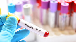 Ketony – sygnał chorobowy czy legalny dopalacz?