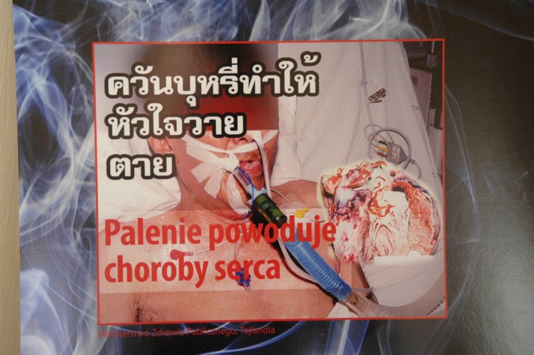 Z okazji Światowego Dnia Bez Tytoniu ministerstwo zdrowia zorganizowało wystawę grafik, jakie w różnych krajach straszą z paczek papierosów