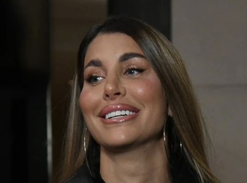 IZGLEDA KAO DŽEK NIKOLSON NAKON BOTOKSA: Supruga Slobe Radanovića se pokajala zbog zahvata!